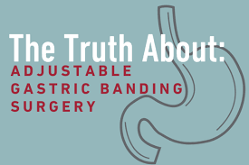 Does united healthcare insurance cover lap band surgery. The Truth About Adjustable Gastric Banding Surgery Temple Health