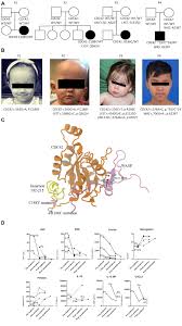 Cdc42bpa cdc42 binding protein kinase alpha. Severe Autoinflammation In 4 Patients With C Terminal Variants In Cell Division Control Protein 42 Homolog Cdc42 Successfully Treated With Il 1b Inhibition Journal Of Allergy And Clinical Immunology