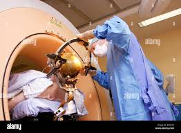 Image result for Thalamic Stimulation