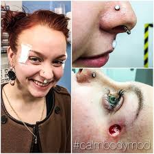 Vælg mellem et stort udvalg af lignende scener. Chai Calm Bodymod Fresh Scarification With White Inkrubbing On