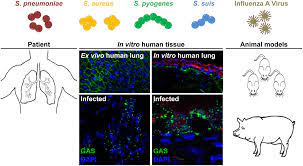 There are three types of flu viruses: Frontiers Port D Entree For Respiratory Infections Does The Influenza A Virus Pave The Way For Bacteria Microbiology