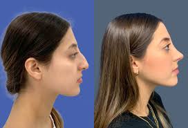 Cirugía plástica en Mexicali