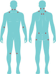 Image result for Tender Point