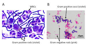 Bacteria 101 Cell Walls Gram Staining Common Pathogens Tusom Pharmwiki