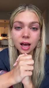 Kate Ritchie Car Accident