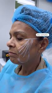 Stephany Carmona (@flawlessskinrd) • Instagram photos and videos