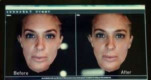 Christians and Plastic Surgery