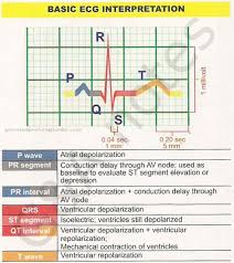 Basic Ecg Interpretation Nursing Mnemonics Nursing Students Critical Care Nursing