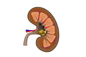 Kidney Stone Causes Symptoms And Size Chart Diseasefix