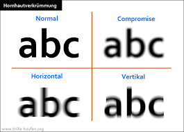 Wenn ihre hornhaut nicht rund, sondern unregelmäßig geformt oder verkrümmt ist, nennt man das hornhautverkrümmung (stabsichtigkeit / astigmatismus). Astigmatismus Stabsichtigkeit Auge