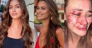 Ukraynali Modele Darp Iddiasi Cesme Kaymakamini Yerinden Etti Model Olay Erkek Arkadaslar