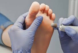 Beetlejuice goes hawaiian opens with the man himself, the ghost with the most, adjusting to a new normal after the events of the first film. Plantar Warts Orleans Dynamic Foot Clinic