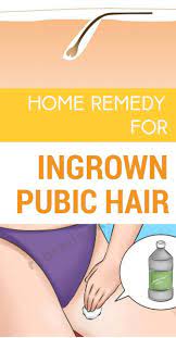 It can happen naturally or it can happen because of shaving, waxing or using any methods of pubic hair removal. Pin On Ingrown Hair Remedies