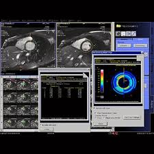 The principle can be extended to incorporate the uptake or release of any substance, eg. Argus Function