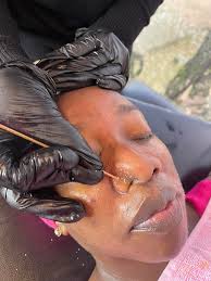 PHIKWE RESIDENTS ONLY