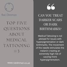 What are the five most asked questions about medical tattooing?
