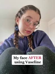 Vaseline