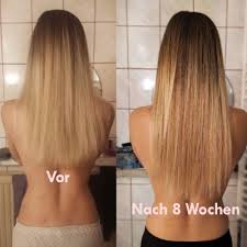 Viele naturheilkundler schwören auf die wirksamkeit. Moea Vegane Haarpflege Offizieller Shop