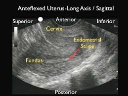 09 Ob Gyn Us 1 Youtube Medical Ultrasound Ultrasound Technician Diagnostic Medical Sonography