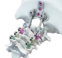 Product-detail | NeuroSpine