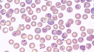 Frequently asked questions about malaria, disease, transmission, symptoms, diagnosis, treatment, complications with pregnancy, prevention, eradication and endemic areas. Malaria Parasites May Have Their Own Circadian Rhythms Science News