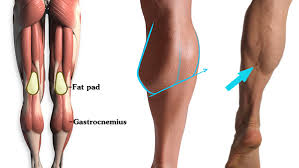 Anatomy muscle chart diagram poster muscle diagram muscle. How To Draw The Calf Proko