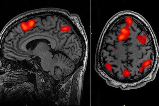 Did you know that people believe after death, the human brain lives on for 7 minutes, replaying its best memories. The popular theory that the brain replays memories for seven minutes after