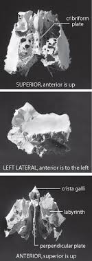 Cribriform Plate An Overview Sciencedirect Topics