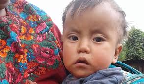 Success! Edwin from Guatemala raised $492 to fund malnutrition treatment.