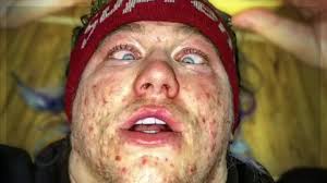 Maybe you would like to learn more about one of these? Why Supreme Patty Is Famous Youtube