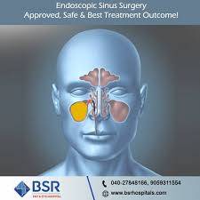 A wide variety of nasal you can also choose from blood vessels removal nasal polyps laser treatment, as well as from online technical support, return and replacement, and. Bsr Ent And Eye Hospitals Hyderabad Or Secunderabad