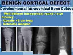 Pin By Fatih Vatansever On Imagenes Rx Bone Diseases Arthritis Disease
