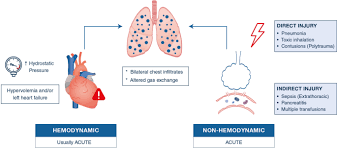 Acute respiratory distress syndrome (ards) occurs when our lungs are severely injured, often by infection or trauma. We Ve Never Seen A Patient With Ards Springerlink