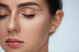 Eyelid Surgery Elkhart