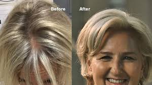 See the best & latest vitamins to promote hair growth on iscoupon.com. 14 Best Supplements For Hair Growth For Women Over 50