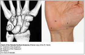 Image result for Pisiform Bone