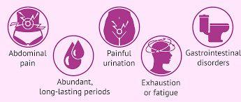 Common signs and symptoms of endometriosis include: Symptoms Of Endometriosis