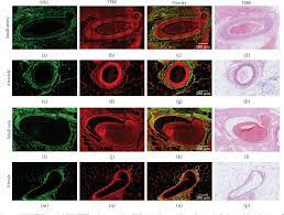 (iv) name the two main stages of urine formation. Pdf Label Free Imaging Of Blood Vessels In Human Normal Breast And Breast Tumor Tissue Using Multiphoton Microscopy Semantic Scholar