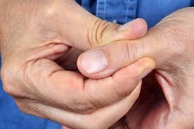 Treatment For Thumb Arthritis: When To Consider Carpometacarpal (CMC)  Arthroplasty - Minnesota Valley Surgery Center