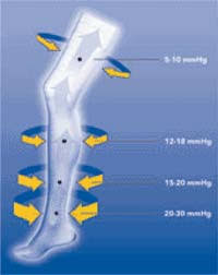 We did not find results for: Compression Stockings After Heart Surgery In Icu