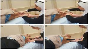 Effect Of Direct Myofascial Release And Kinesio Tape On Axillary Web Syndrome Scialert Responsive Version