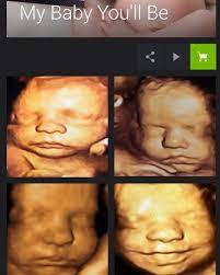 My Baby You Ll Be 4d Ultrasound Home Facebook