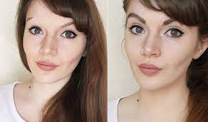 You cant reduce white hair. How To Cover Vitiligo Eyebrows With Makeup For A Boost Of Empowerment Photos Vitiligo Treatment Vitiligo Hair Treatment