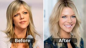Kaitlin Olson Plastic Surgery: From Natural Beauty to Cosmetic Adventure