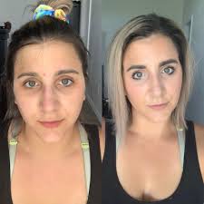 Wockeisha Got A Face Lift 😮‍💨⭐️