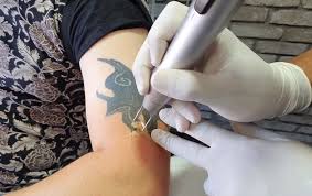 Kapatma dövme,cover up tattoo,şişli dövme,nişantaşi dövme,mecidiyeköy dövme,tattoomix Dovme Sildirme Fiyatlari 2021 Dovme Sildirme Nasil Yapilir Iz Kalir Mi Acitir Mi Dogru Ve Guncel Hayattan Haberler