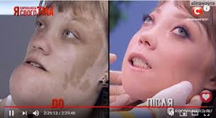 я стесняюсь своего тела новый сезон на русском языке Ya Soromlyus Svogo Tila Ya Stesnyayus Svoego Tela Edinstvennaya Peredacha Kotoroj Ya Veryu Tv Shou V Kotorom Pokazyvayut Uvechya Bolezni Polovye Organy I Operacii Bez Cenzury No Vylechivayut Lyudej Otzyvy Pokupatelej