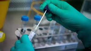 Koronavirüs salgını tespitinde ve tedavisinde. Pcr Testi Nedir Nasil Yapilir Iste Detaylar Son Dakika Haberleri