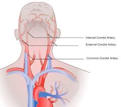 Image result for carotid artery