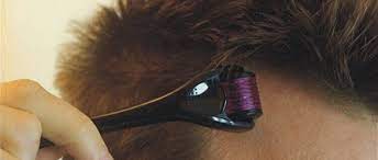1) it enables the patient to separate hairs, allowing light to penetrate directly to the scalp and 2) it helps the patient maintain a safe, consistent distance between the device and his skin. Services Derma Roller Treatment From Thrissur Kerala India By Dr Pais Hair Grow Clinic Id 5428661